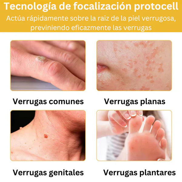 Tag Recede Eliminador de Verrugas